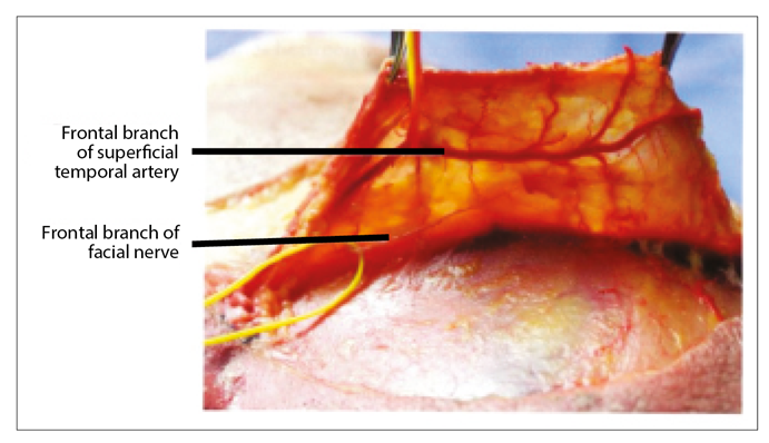Temple restoration | The PMFA Journal