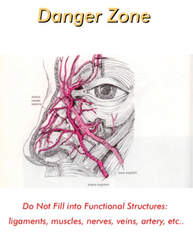 HOW I DO IT Nose reshaping using advanced fillers The PMFA Journal