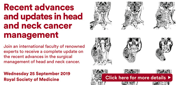RSM head & neck cancer image
