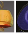 CT images of segmented subcutaneous adipose tissue. 