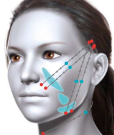 Full face treatment illustration