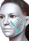 Full face treatment illustration