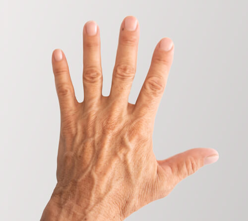 Before and after photos pic - before