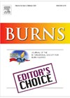 Burns journal front cover