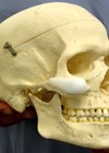 Photo of skull to highlight the optimal position of a malar implant 