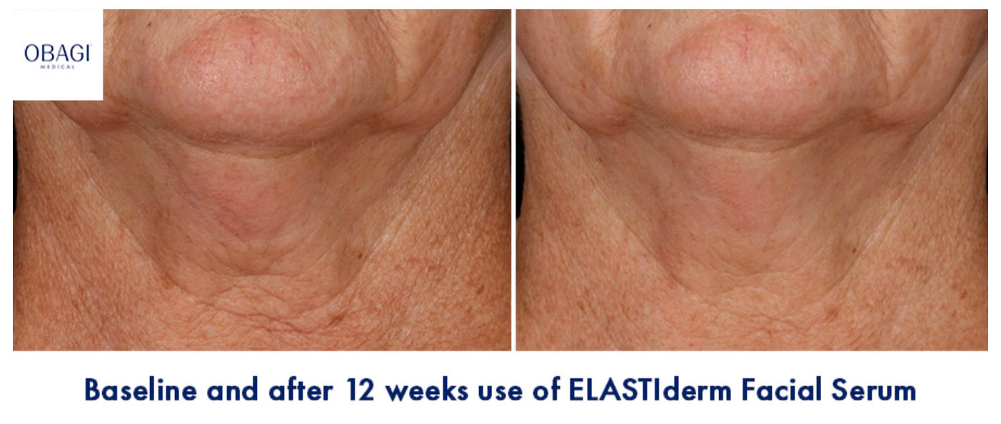obagi elastiderm face serum