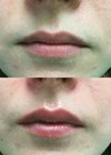 Photos show patient before (above) and after (below) procedure