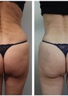 Luis Campos article before (left) and after (right) photos.