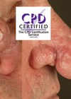 Rhinophyma article photo with CPD stamp.