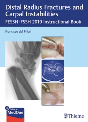 Distal Radius Fractures and Carpal Instabilities FESSH IFSSH 2019 Instructional Book cover image.