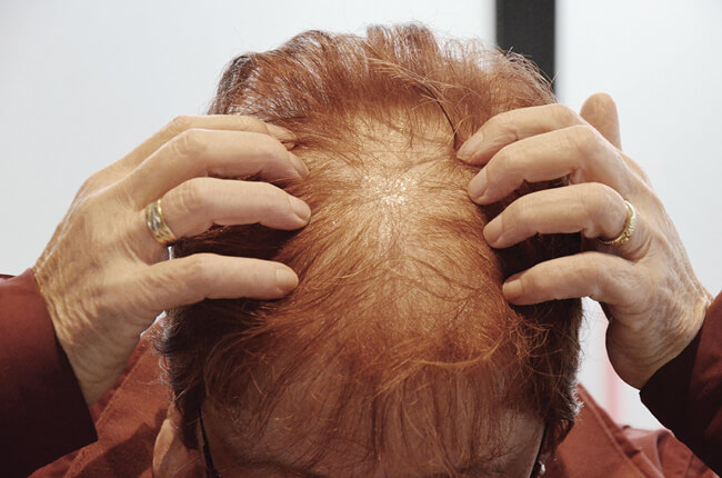 Patient photograph before treatment 