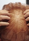 Patient photograph before treatment