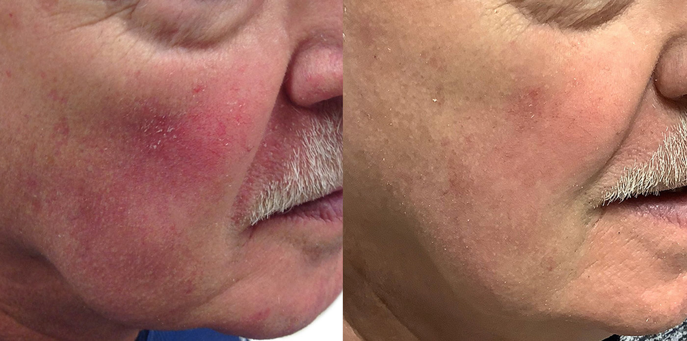 How I Do It Jun/July 2021 - before and after images.