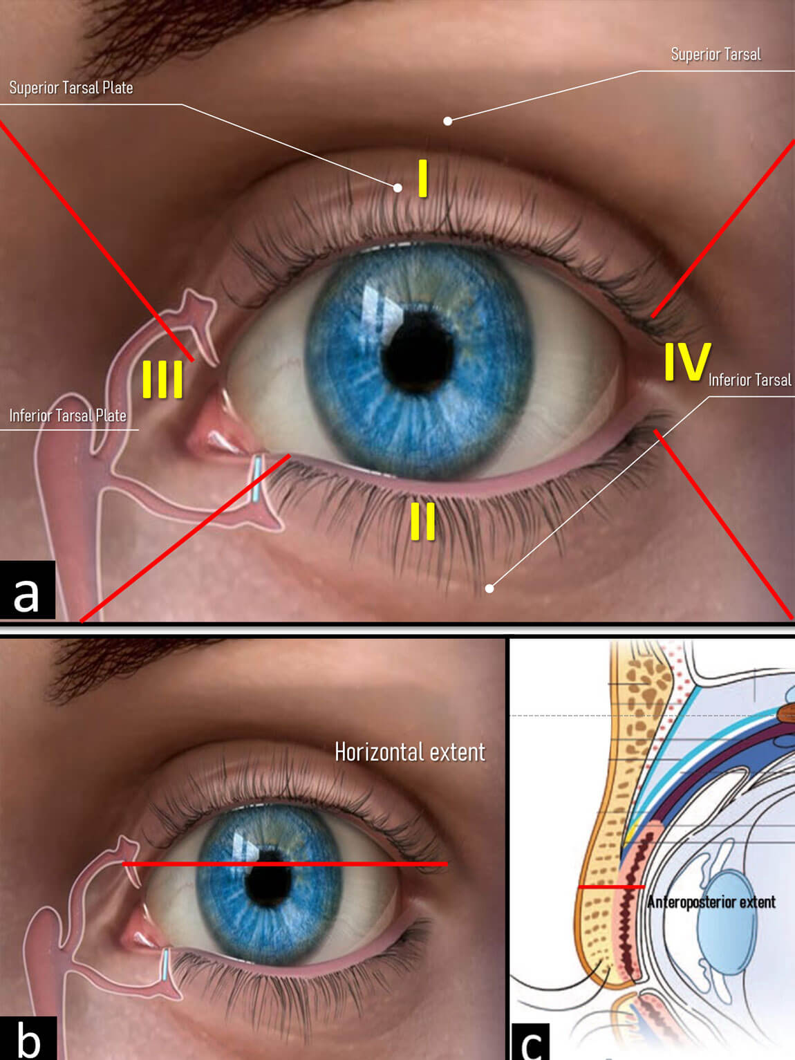 Illustration showing zone topography according to the SPOT classification. 