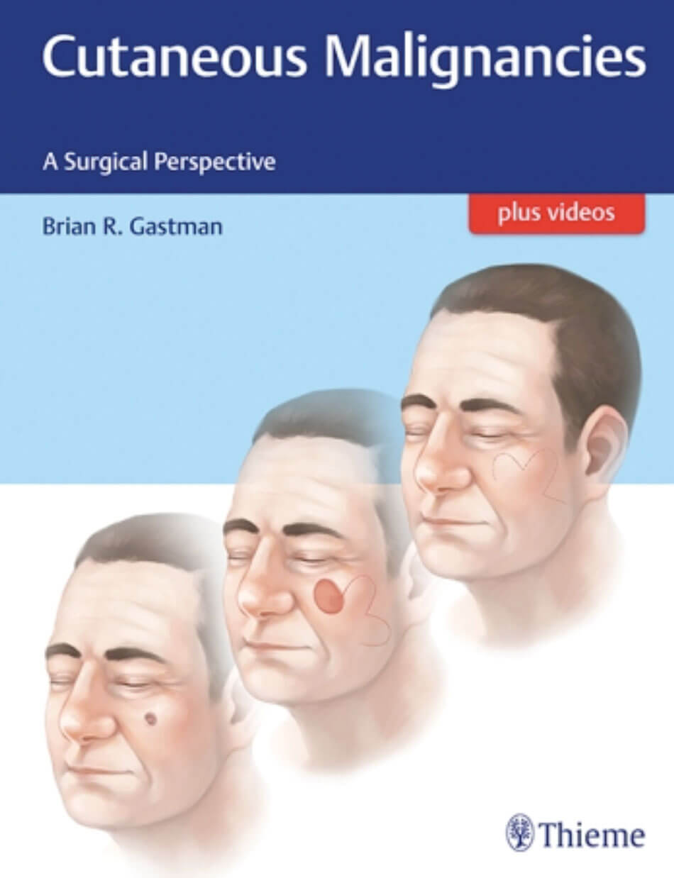 Cutaneous Malignancies: A Surgical Perspective book cover image.