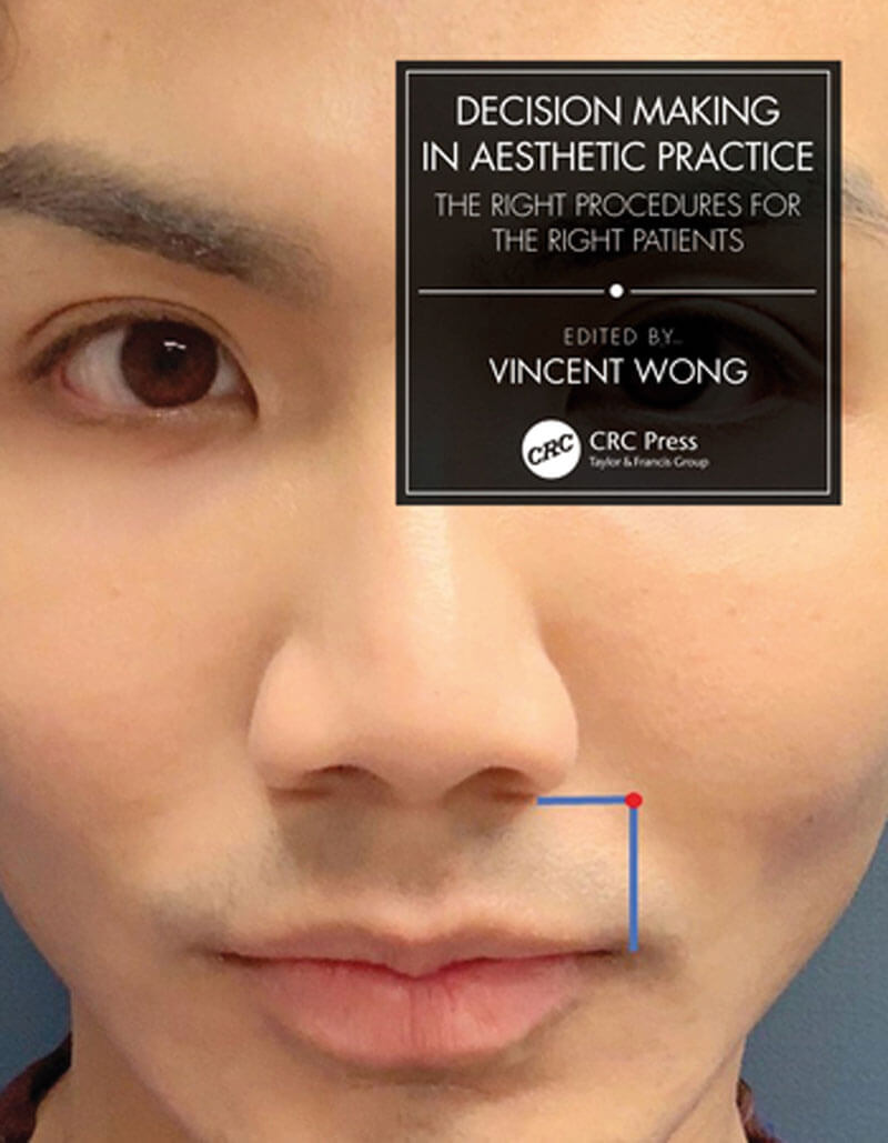 Decision Making in Aesthetic Practice book cover image.