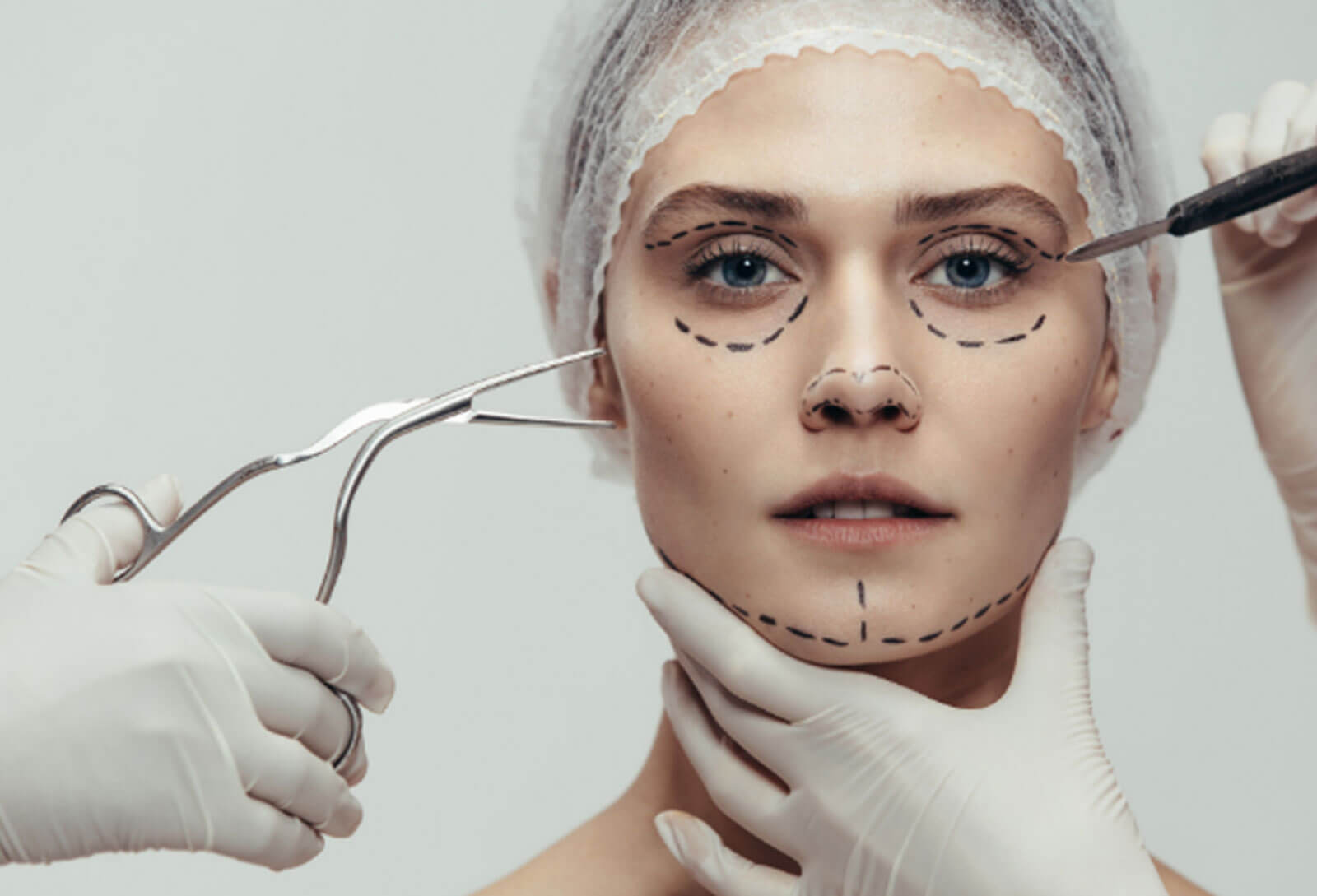 Photo of woman being prepared for procedure. 