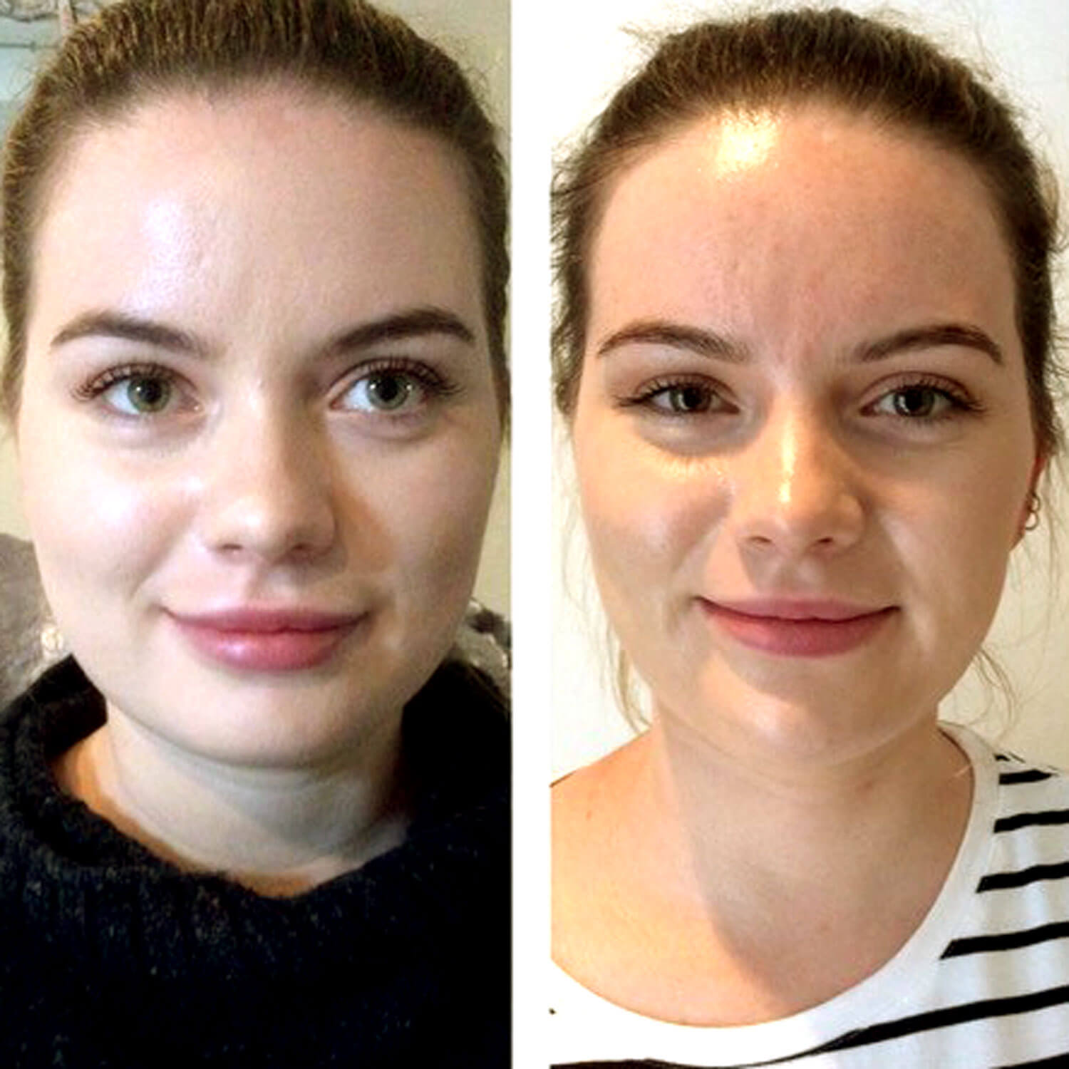 Before and after photos of the patient. 