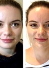 Before and after photos of the patient.