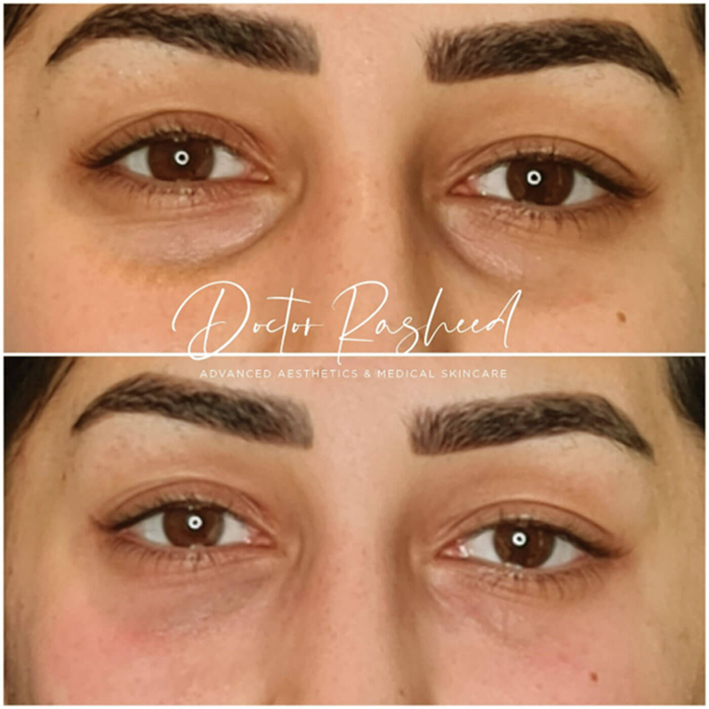 Before and after images from the author’s practice.