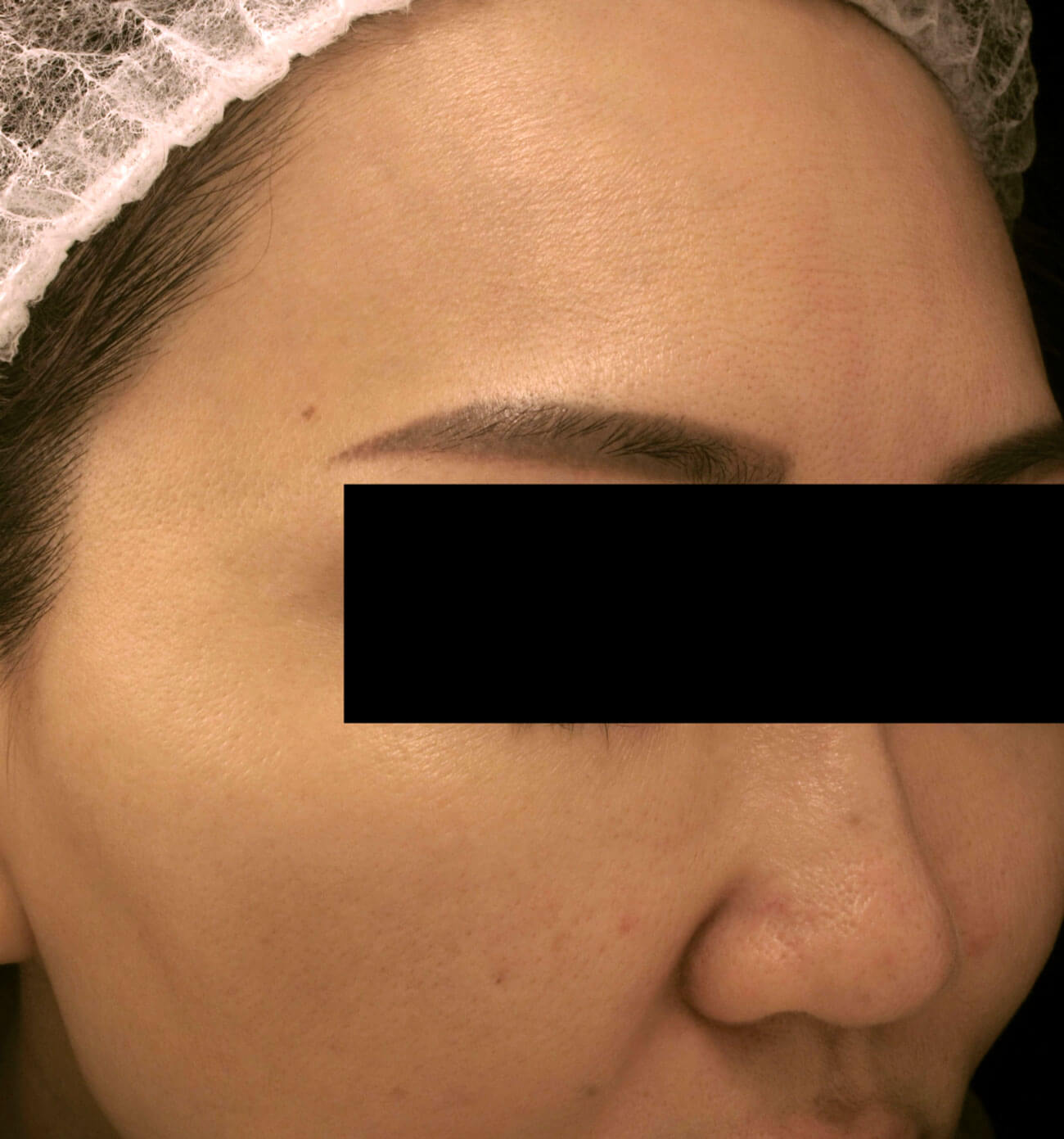 Photo showing patient after treatment.