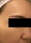 Photo showing patient after treatment.