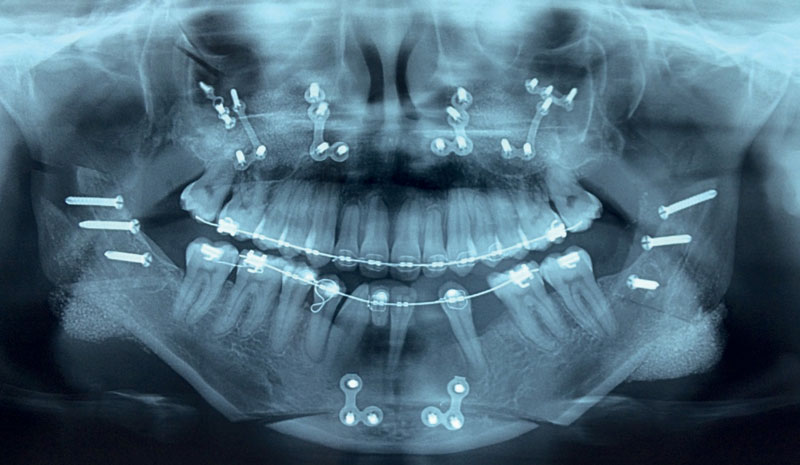 Contemporary aesthetic management Posture of mandible definition of