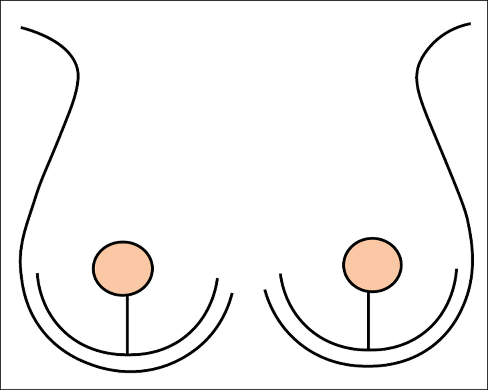Illustration showing breasts. 