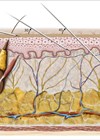 Schematic representation of skin layers and injection techniques.