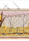 Schematic representation of skin layers and injection techniques. 