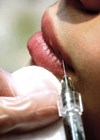 Photo of lip injection.
