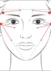 Illustration of facial areas for treatments of liquid polycaprolactone.