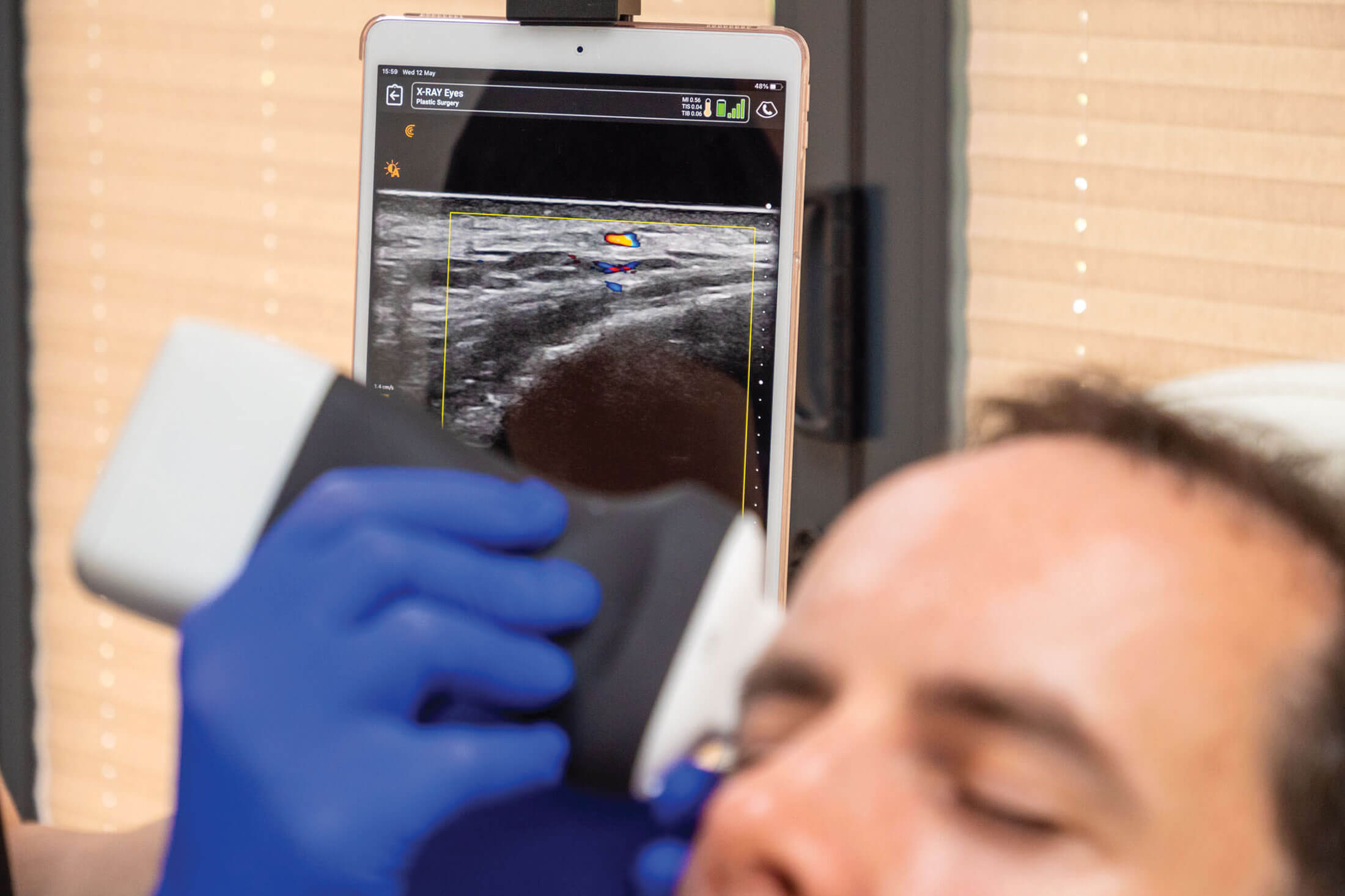 Photo showing scanning a patient with a handheld ultrasound device. 