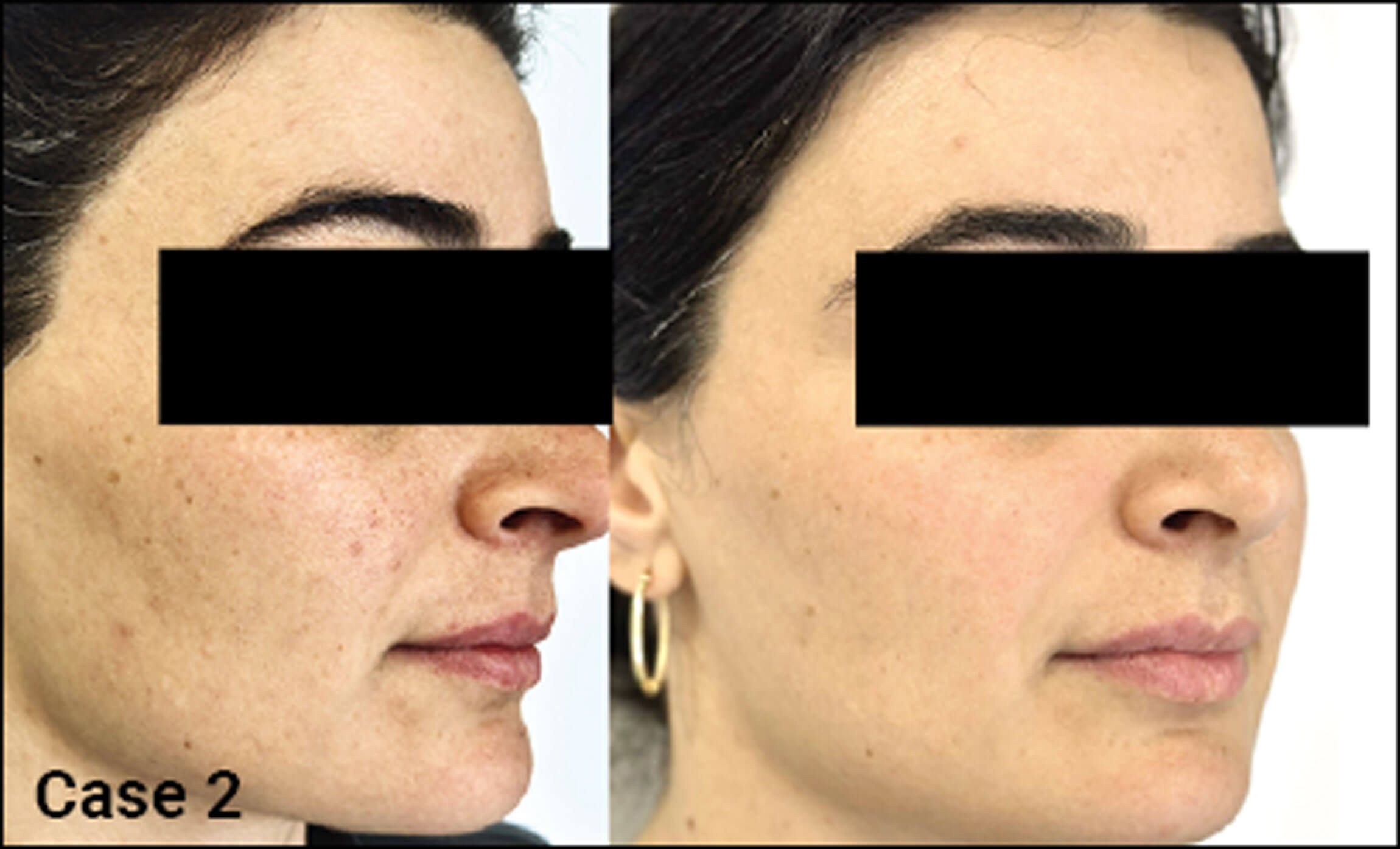 Before and after photos for Case 2.