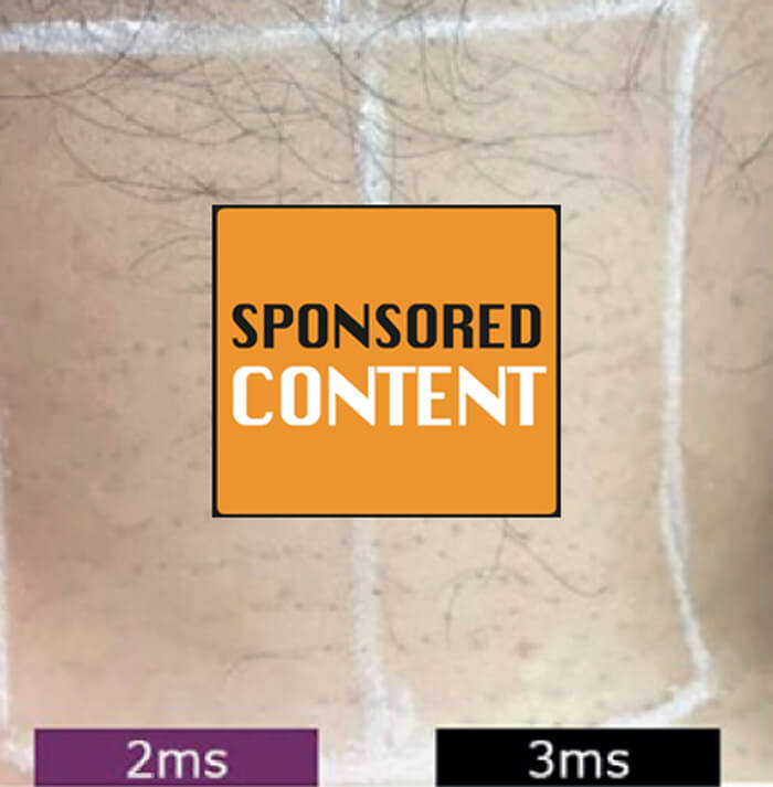 Candela article graphic image.