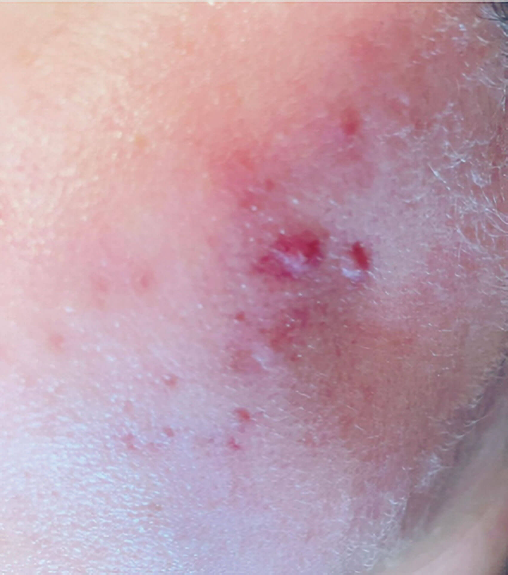 Photo showing before treatment.