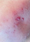 Photo showing before treatment.