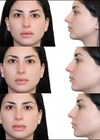 Pictures of Model 2.