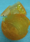 Image showing a ruptured silicone breast implant.