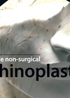 How I Do It - The non-surgical rhinoplasty graphic link image.