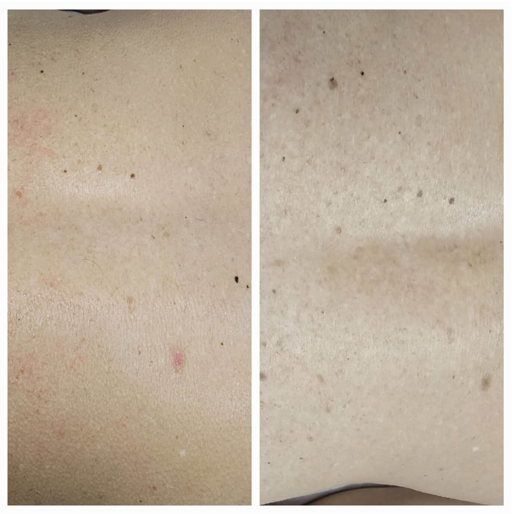 Photos showing pigmentation issues.