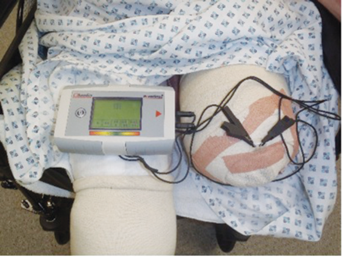 Wound moisture sensing in traumatic wounds The PMFA Journal