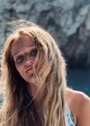 Photo of Chloé who developed keloid scarring following surgery.