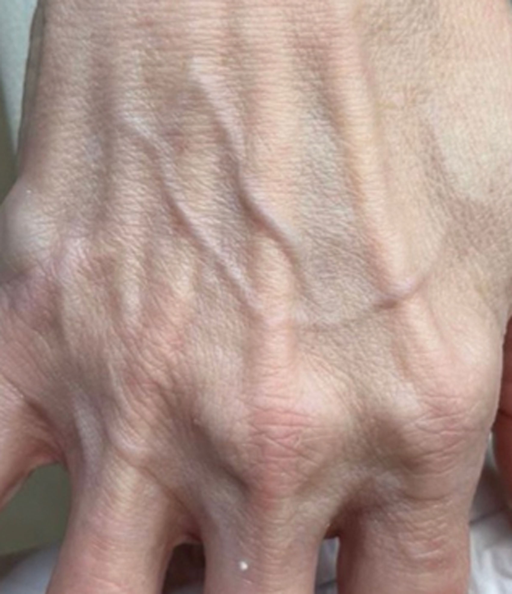 Close up image of hand.