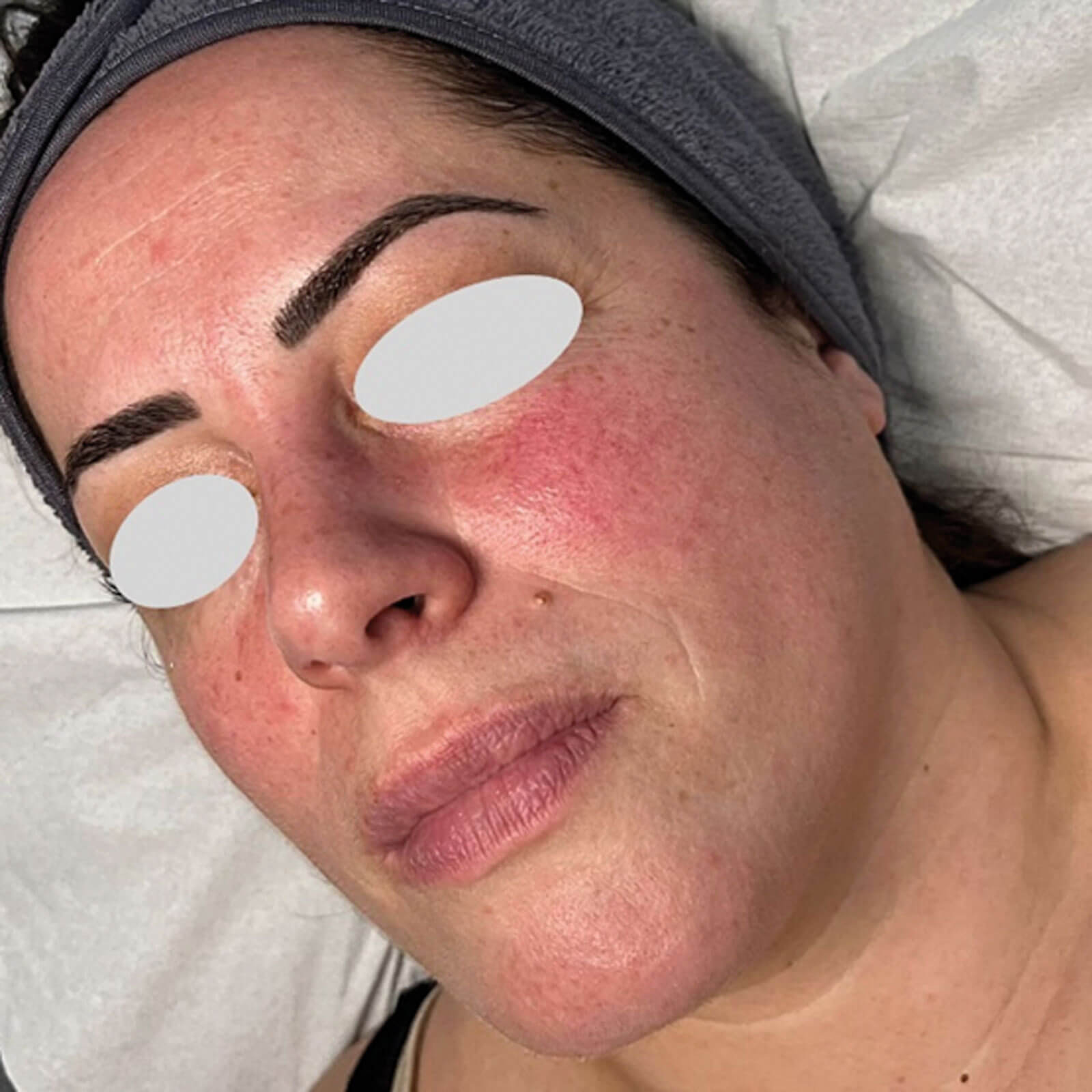 Photo of patient 1 before treatment.