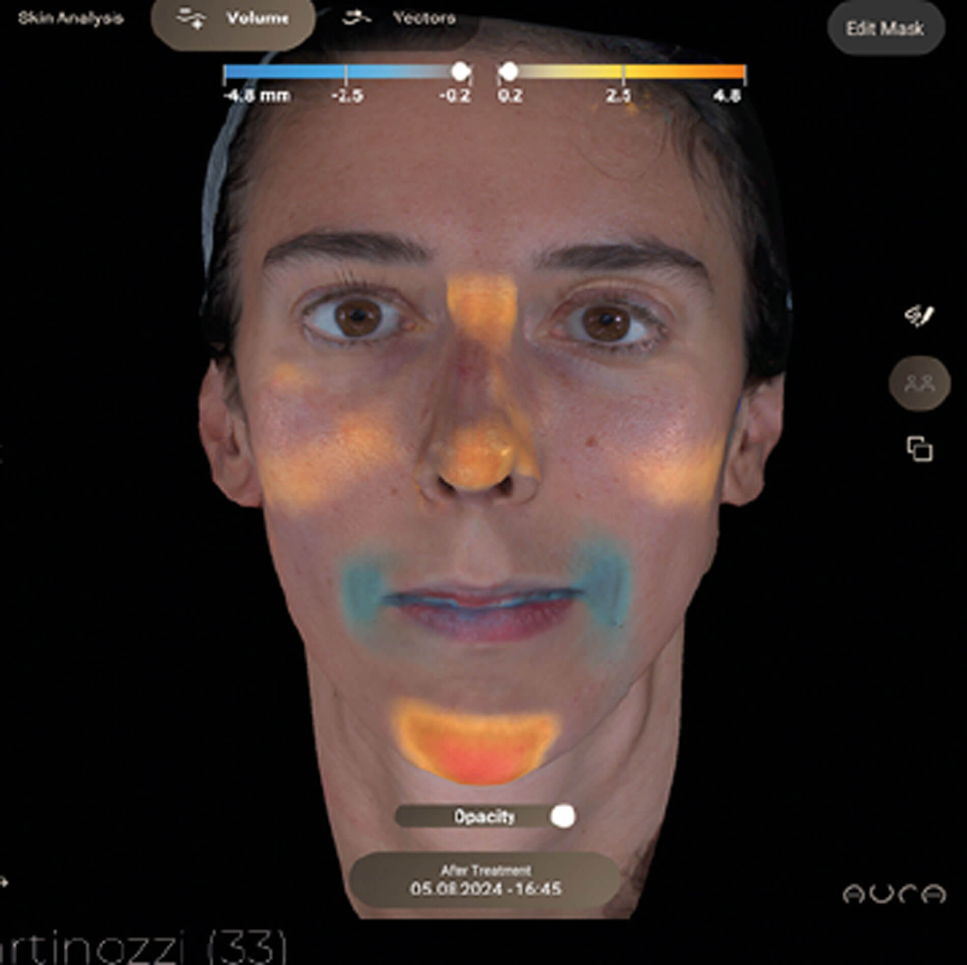 Screengrab showing AURA 3D imaging system.