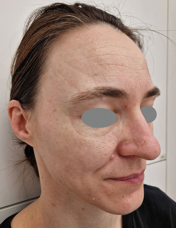 Photo showing patient before treatment.