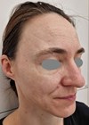 Photo showing patient before treatment.
