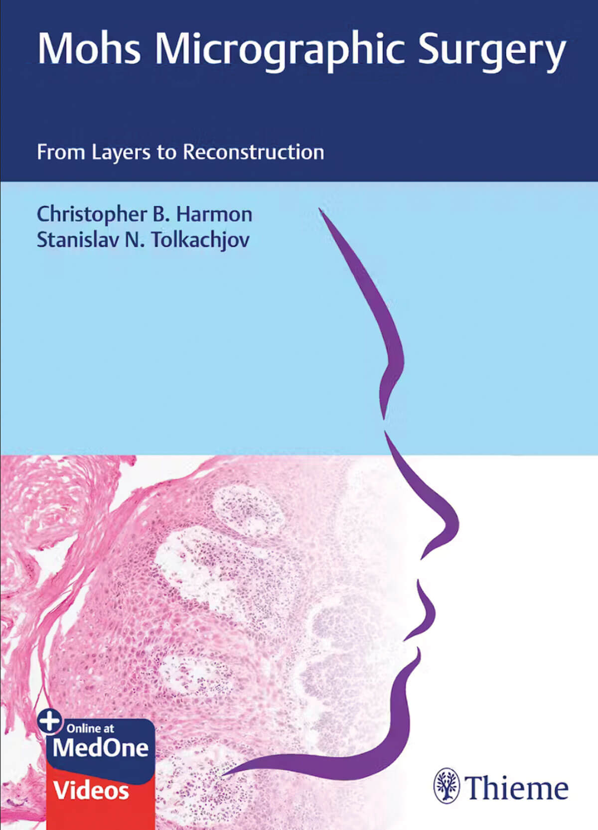 Mohs Micrographic Surgery: From Layers to Reconstruction book cover image.