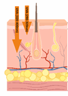 Penetration of ultraviolet radiation to skin’s layers image.
